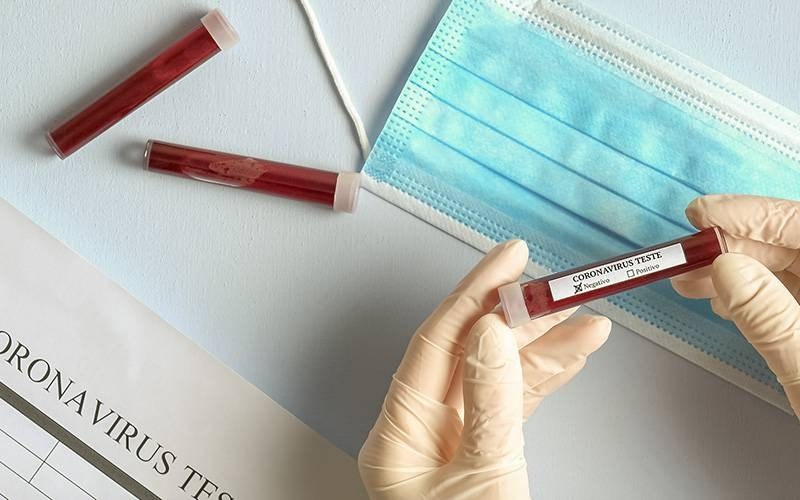 CURADO! – Alagoano com coronavírus apresenta melhora