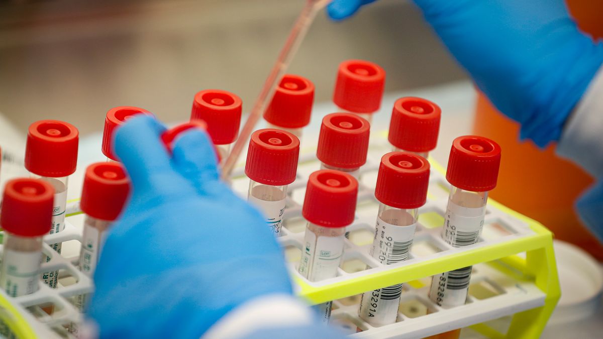 MEDICAMENTO SECRETO - Cientistas testam remédio que reduz 94% da carga viral da covid-19