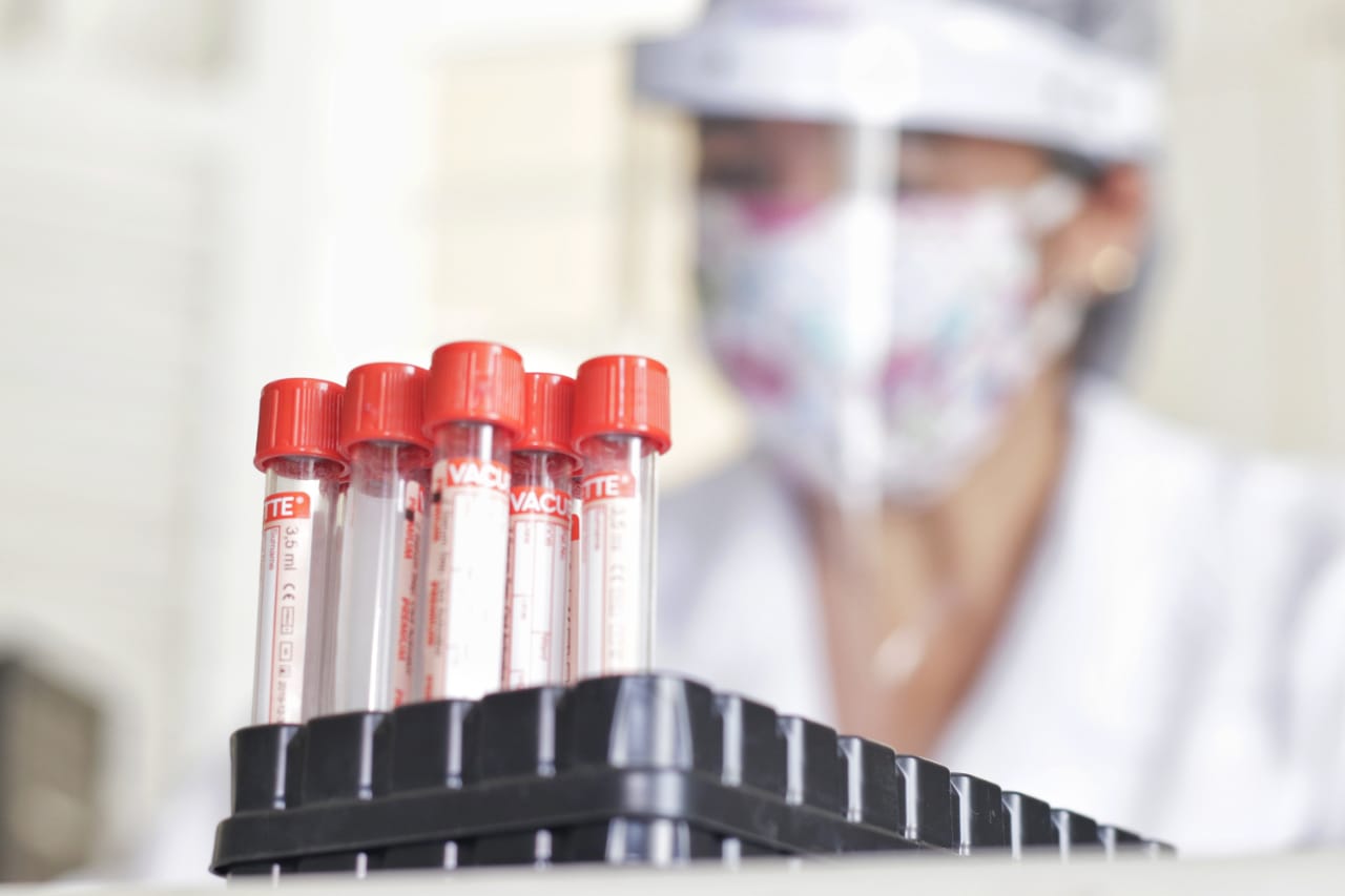 PANDEMIA - Prefeitura de Palmeira dos Índios e SMS publicam relação dos bairros mais atingidos pela Covid-19