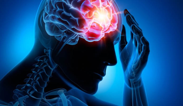 Conheça mitos e verdades sobre o AVC !